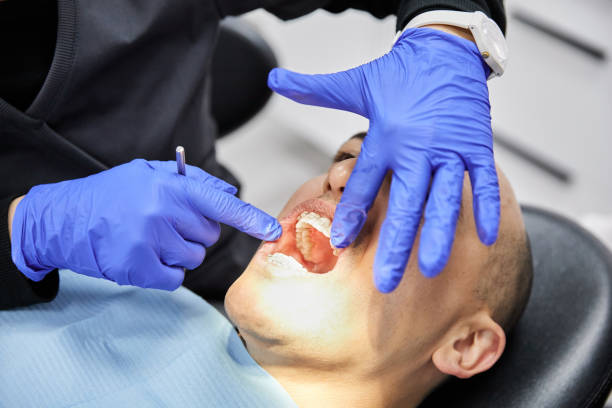 Best Emergency Wisdom Teeth Removal in Remgton, IN